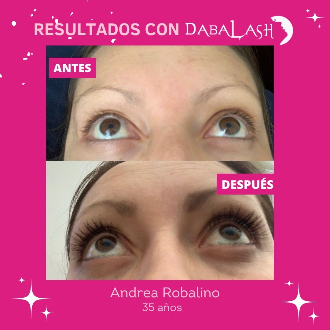 Testimonios de crecimiento de pesta&ntilde;as 